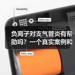 负离子对支气管炎有帮助吗?一个真实案例和3个实验结果,看完少走半年弯路(图3) 负离子对支气管炎有帮助吗?一个真实案例和3个实验结果,看完少走半年弯路(图3)