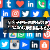 负离子祛痘真的有效吗?3400块亲测结果揭露真相(图3) 负离子祛痘真的有效吗?3400块亲测结果揭露真相(图3)